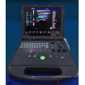 Máquina profissional do ultra-som do ecocardiography do doppler da cor 3d feita em China